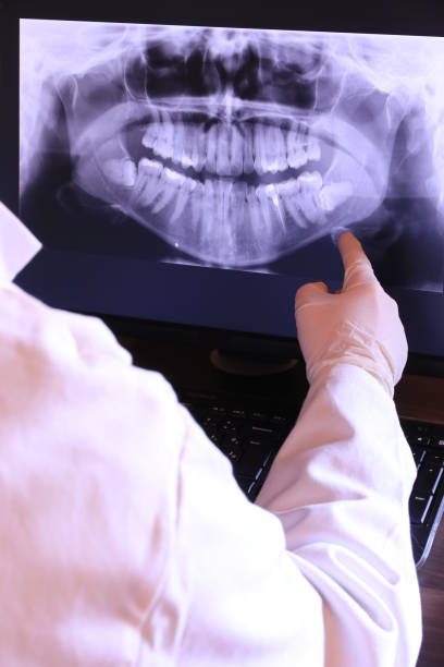 Best Emergency Wisdom Teeth Removal in Red Boiling Springs, TN