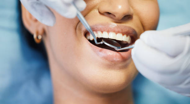Best Emergency Dental Care for Broken or Chipped Teeth in Red Boiling Springs, TN